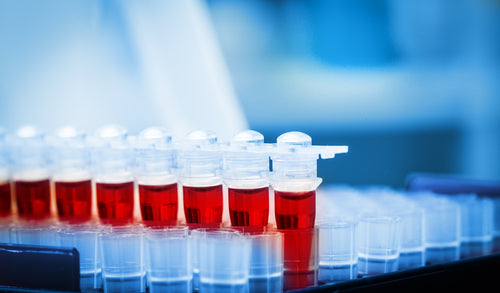 PSA Test Scores: What Your Doctor Isn’t Telling You
