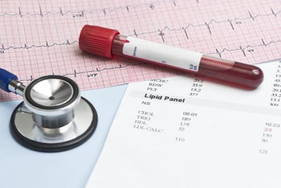 Comprensión de sus análisis de sangre: colesterol