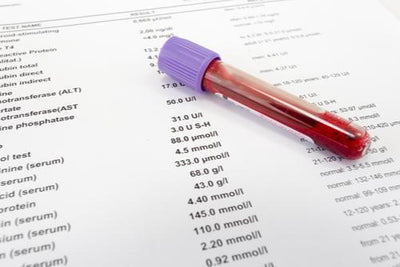 Comprensión de sus análisis de sangre: Salud renal
