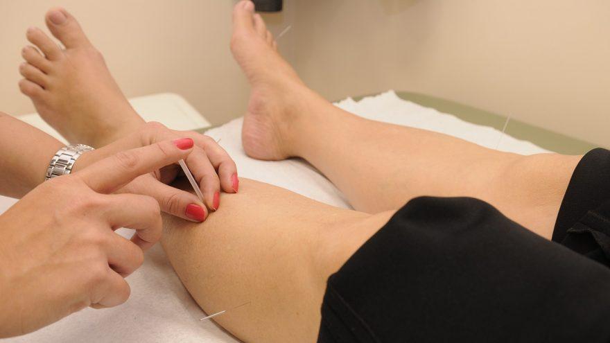 Does Acupuncture Work? A List of Treatable Conditions