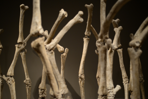 Proton Pump Inhibitors Endanger Your Bones